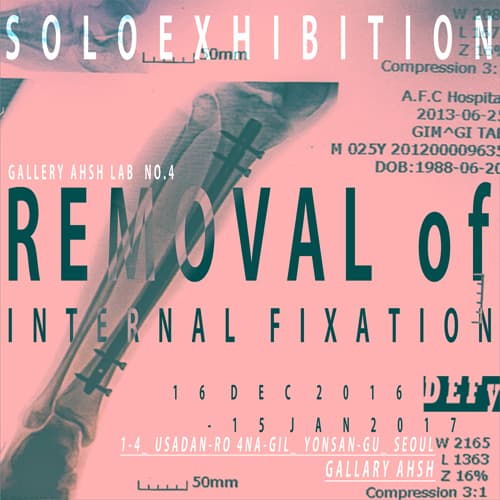 REMOVAL of INTERNAL FIXATION