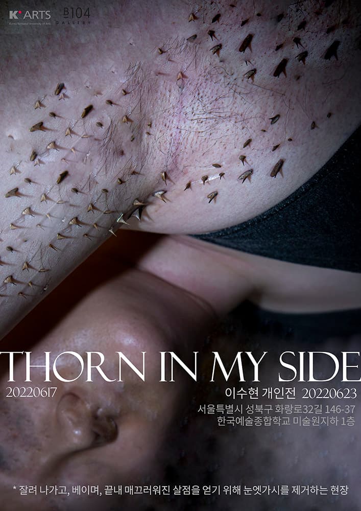 이수현 개인전: Thorn in my side 1