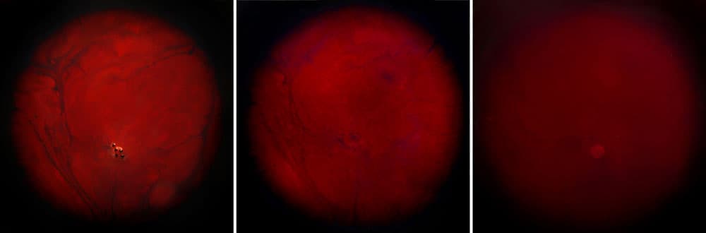 이호영_사이 #25_Inkjet-print_80X320cm_2015