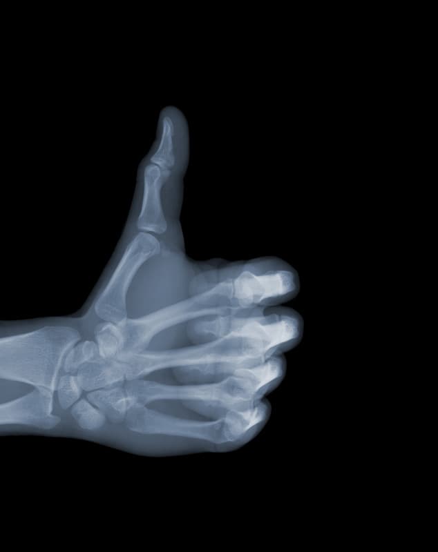 ⓒ Nick Veasey